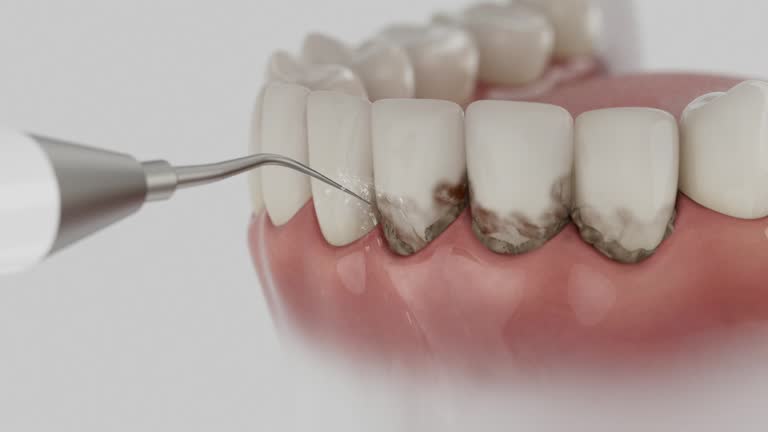Reliable Dental contractor in Berryville, TX by Smile Center Dentistry